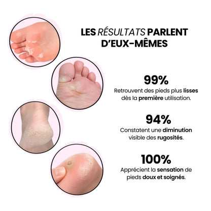 Râpe Électrique pour Pieds