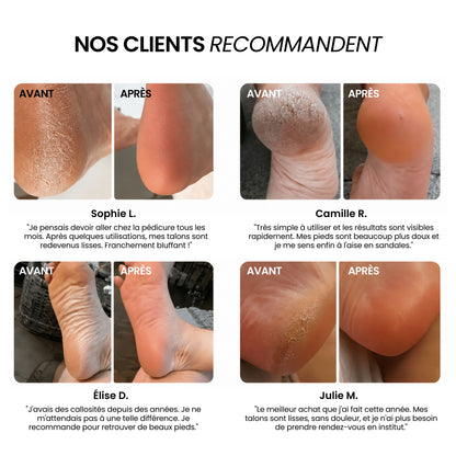Râpe Électrique pour Pieds