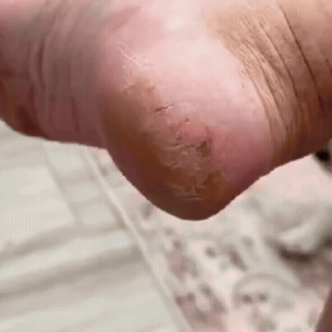 Râpe Électrique pour Pieds